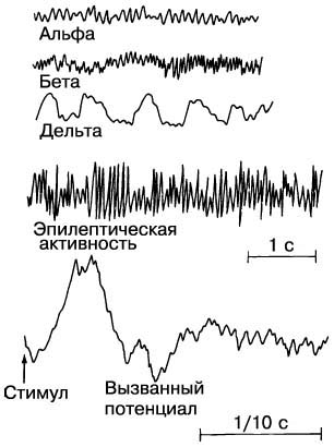 вязаные шапки-модные в 2012году