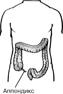Аппендикс у человека рудимент. Червеобразный аппендицит. Червеобразный отросток аппендикс.