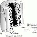 КОСТЬ