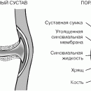 АРТРИТ